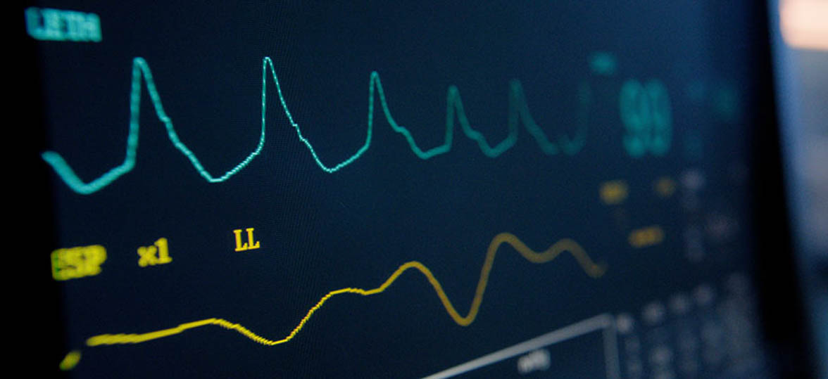Close up of vital signs on a screen